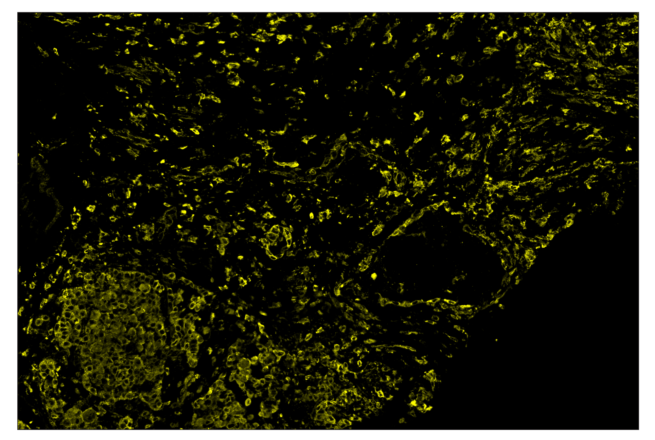 Immunohistochemistry Image 3: MHC Class II (LGII-612.14) & CO-0105-647 SignalStar™ Oligo-Antibody Pair