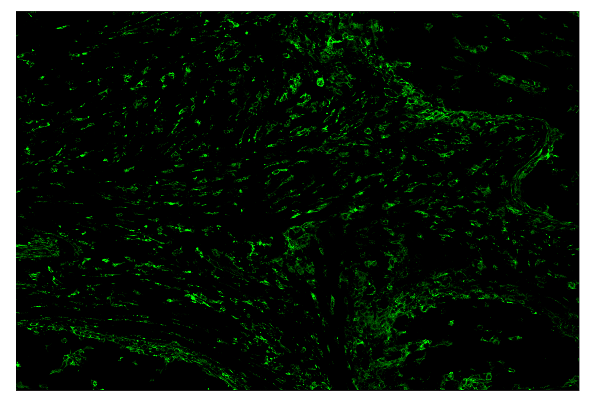 Immunohistochemistry Image 2: MHC Class II (LGII-612.14) & CO-0105-647 SignalStar™ Oligo-Antibody Pair