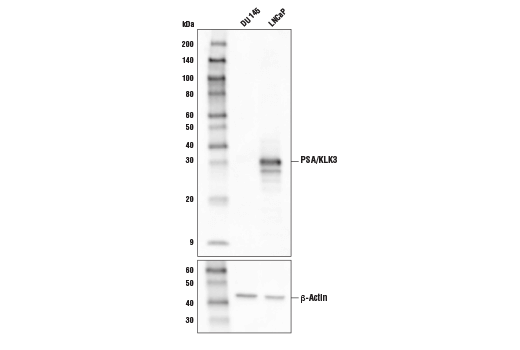 Western Blotting Image 1: PSA/KLK3 (D6B1) XP® Rabbit mAb (Biotinylated)