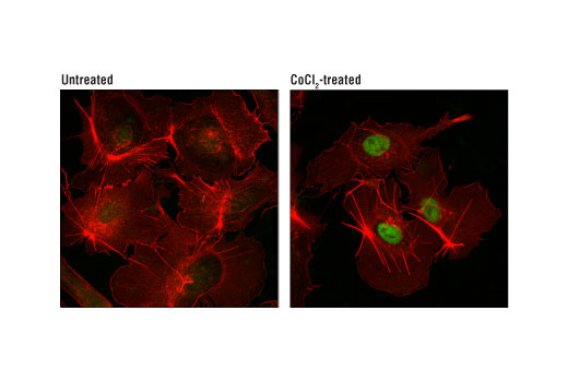 Immunofluorescence Image 1: HIF-1α (D5F3M) Mouse mAb