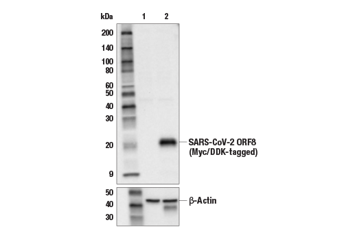 Western Blotting Image 1: SARS-CoV-2 ORF8 Antibody