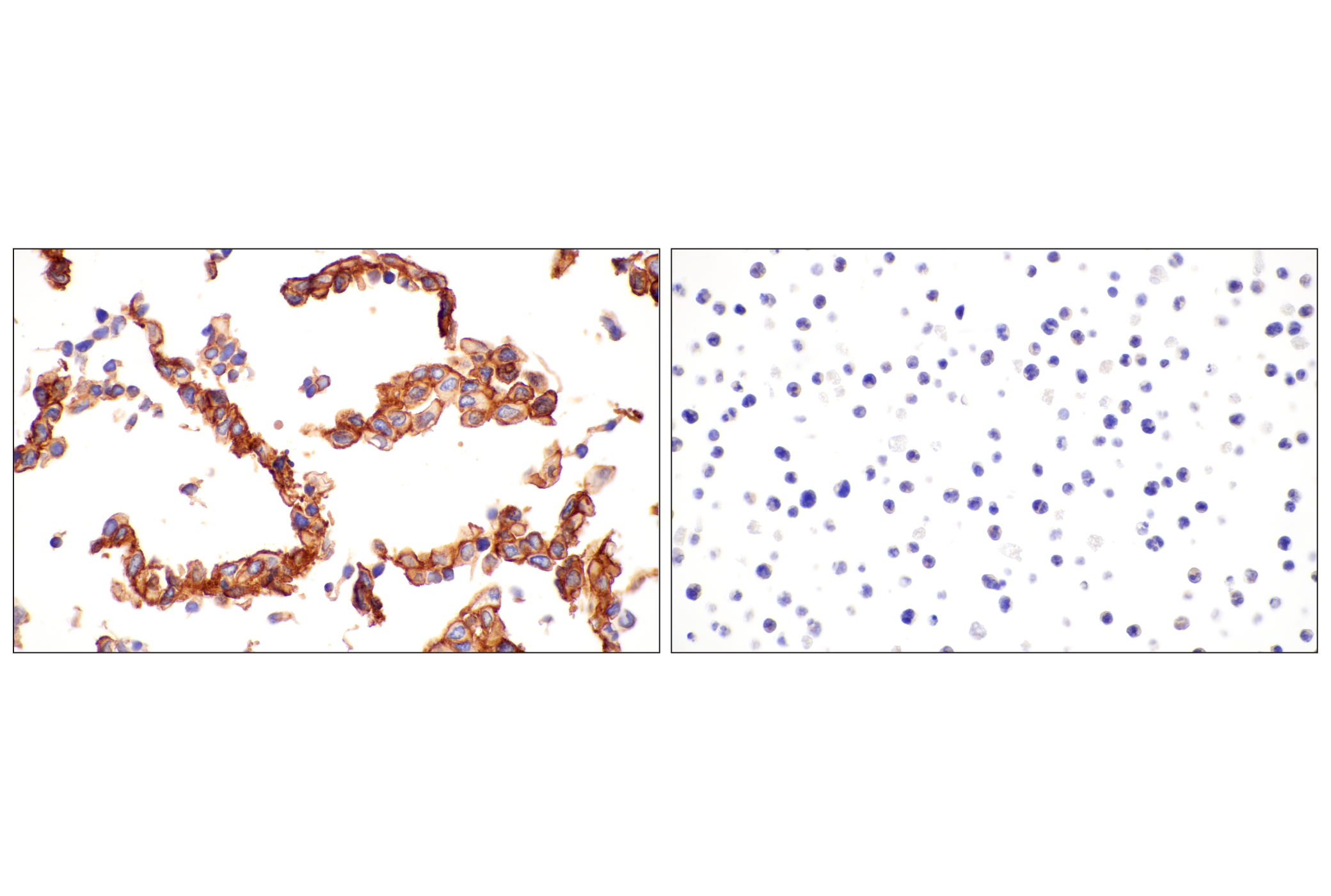 Immunohistochemistry Image 3: CD81 (D5O2Q) Rabbit mAb (BSA and Azide Free)