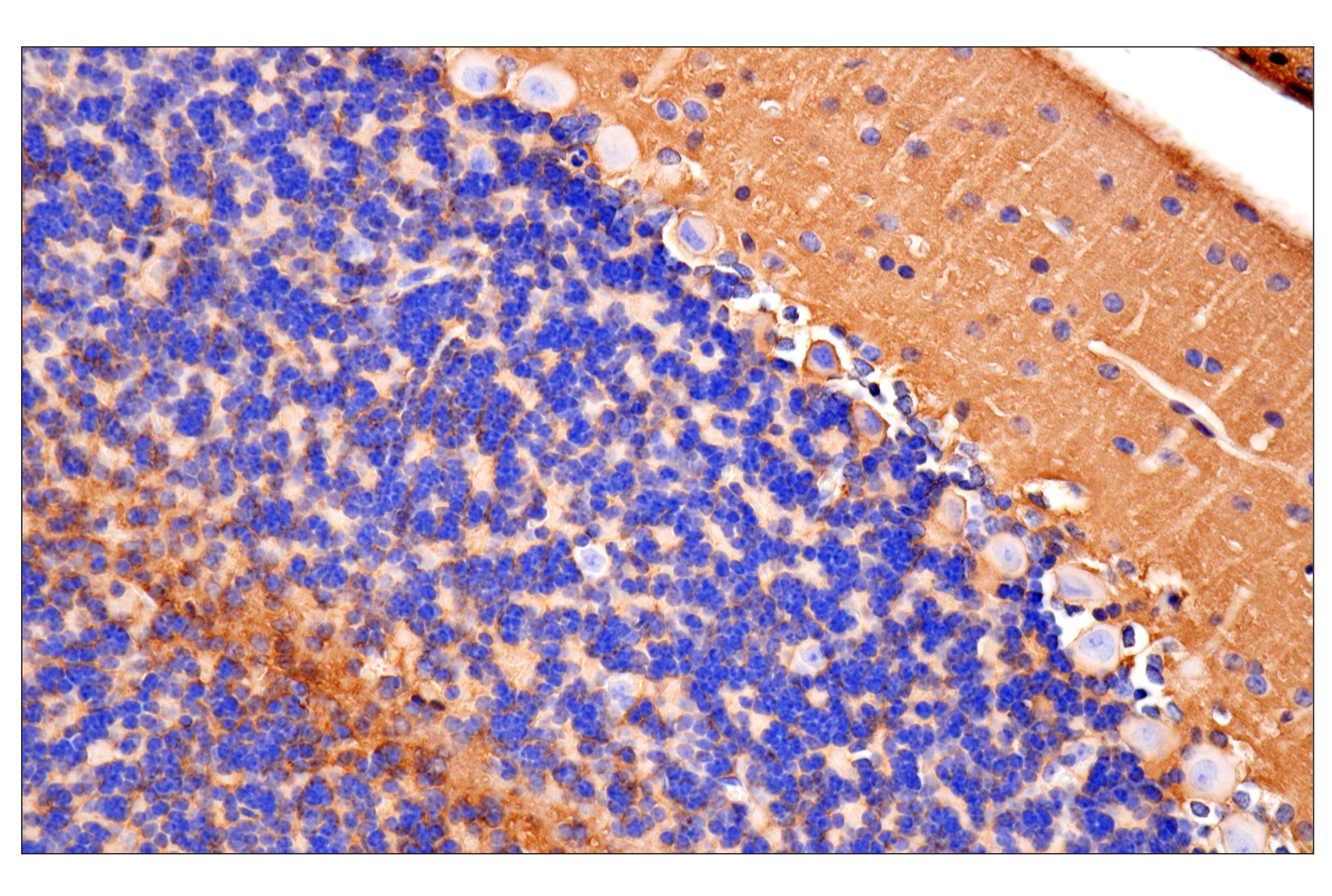 Immunohistochemistry Image 4: CD81 (D5O2Q) Rabbit mAb (BSA and Azide Free)