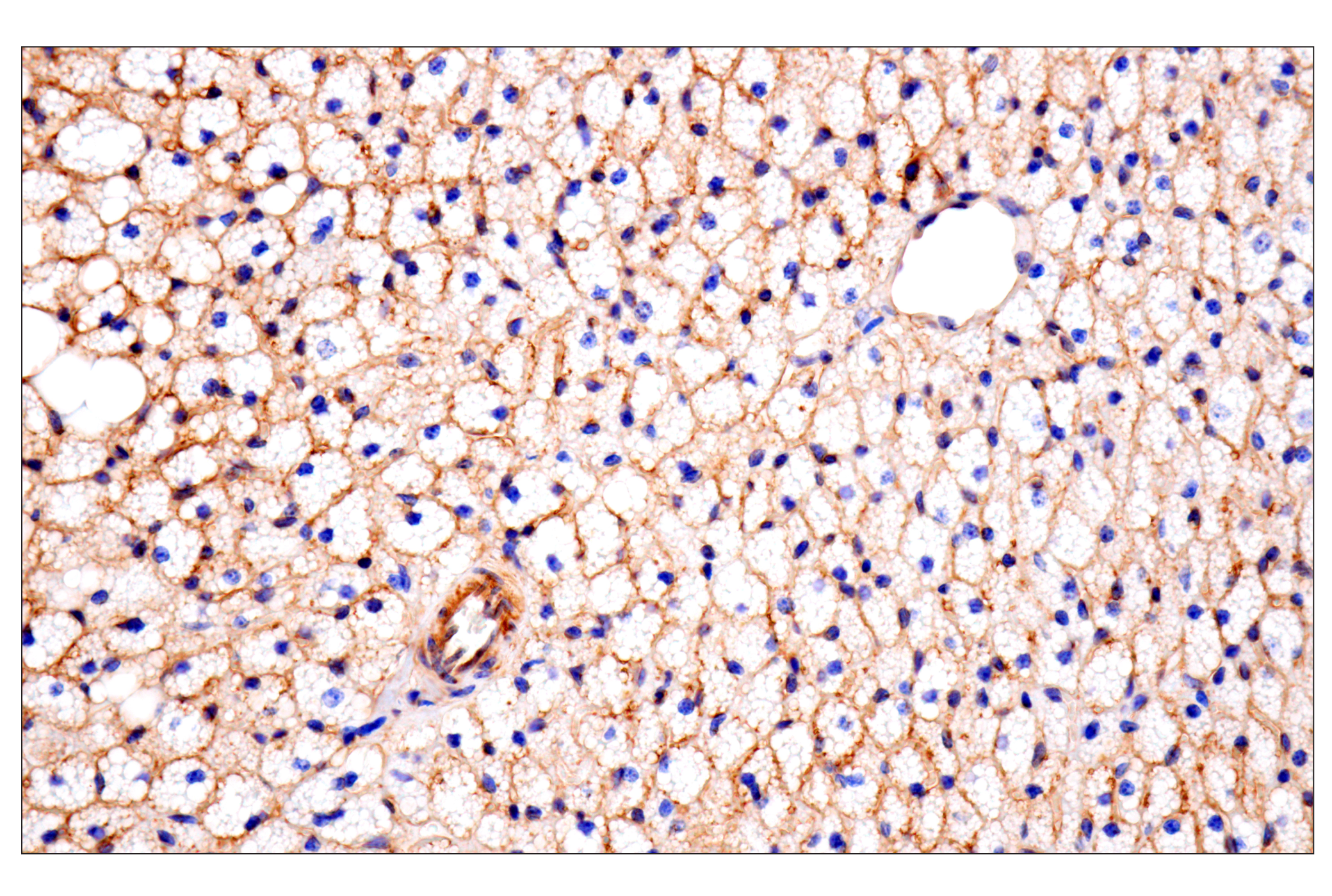 Immunohistochemistry Image 6: CD81 (D5O2Q) Rabbit mAb (BSA and Azide Free)