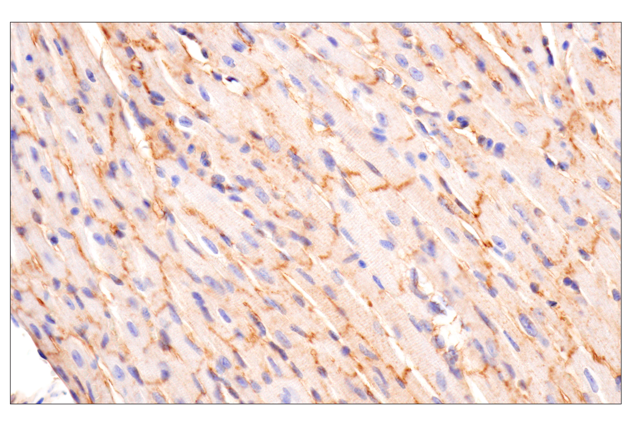 Immunohistochemistry Image 9: CD81 (D5O2Q) Rabbit mAb (BSA and Azide Free)
