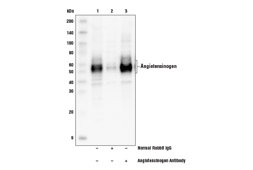 Immunoprecipitation Image 1: Angiotensinogen Antibody
