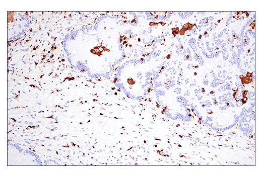 Immunohistochemistry Image 11: Iba1/AIF-1 (E4O4W) XP® Rabbit mAb (BSA and Azide Free)