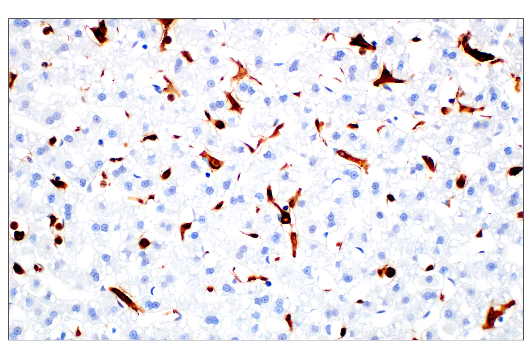 Immunohistochemistry Image 1: Iba1/AIF-1 (E4O4W) XP® Rabbit mAb (BSA and Azide Free)