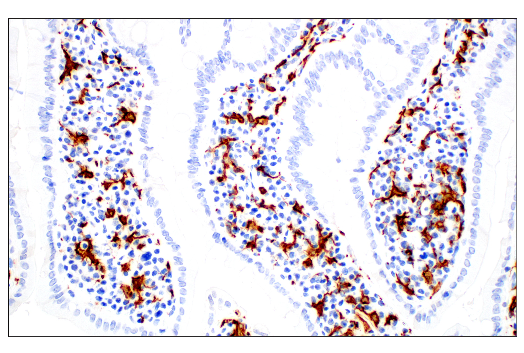 Immunohistochemistry Image 3: Iba1/AIF-1 (E4O4W) XP® Rabbit mAb (BSA and Azide Free)