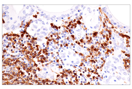 Immunohistochemistry Image 1: TNFRSF13C/BAFF-R (E3C1Q) XP® Rabbit mAb (BSA and Azide Free)