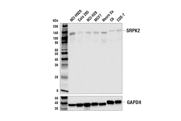 Western Blotting Image 1: SRPK2 Antibody