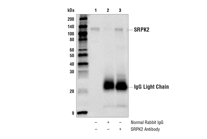 Immunoprecipitation Image 1: SRPK2 Antibody
