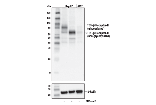 Western Blotting Image 1: TGF-β Receptor II Antibody