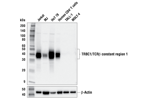 Western Blotting Image 1: TRBC1/TCRβ constant region 1 (E6Z3S) Rabbit mAb (BSA and Azide Free)