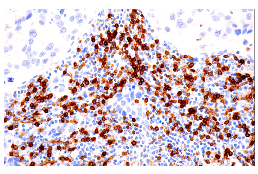 Immunohistochemistry Image 1: TRBC1/TCRβ constant region 1 (E6Z3S) Rabbit mAb