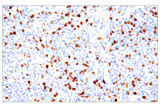 Immunohistochemistry Image 1: TRBC1/TCRβ constant region 1 (E6Z3S) Rabbit mAb (BSA and Azide Free)