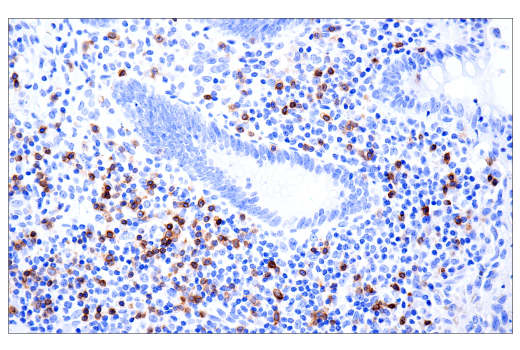 Immunohistochemistry Image 3: TRBC1/TCRβ constant region 1 (E6Z3S) Rabbit mAb