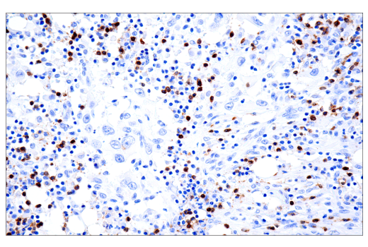 Immunohistochemistry Image 4: TRBC1/TCRβ constant region 1 (E6Z3S) Rabbit mAb (BSA and Azide Free)