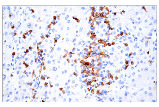 Immunohistochemistry Image 6: TRBC1/TCRβ constant region 1 (E6Z3S) Rabbit mAb