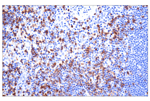 Immunohistochemistry Image 3: TRBC1/TCRβ constant region 1 (E6Z3S) Rabbit mAb (BSA and Azide Free)