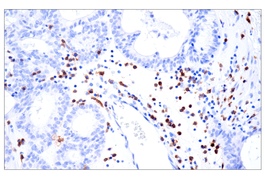 Immunohistochemistry Image 9: TRBC1/TCRβ constant region 1 (E6Z3S) Rabbit mAb (BSA and Azide Free)
