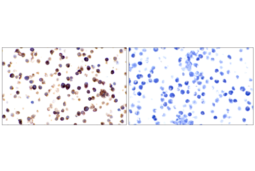 Immunohistochemistry Image 7: TRBC1/TCRβ constant region 1 (E6Z3S) Rabbit mAb (BSA and Azide Free)