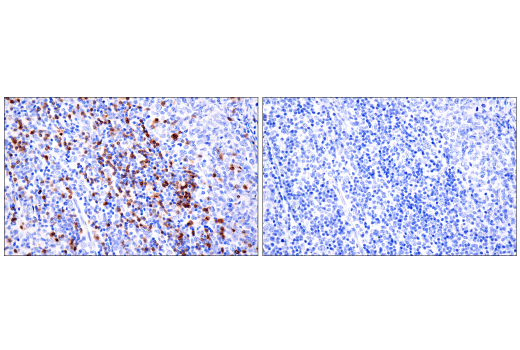 Immunohistochemistry Image 8: TRBC1/TCRβ constant region 1 (E6Z3S) Rabbit mAb (BSA and Azide Free)