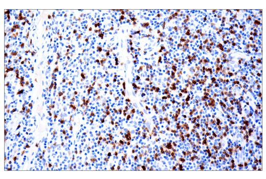 Immunohistochemistry Image 11: TRBC1/TCRβ constant region 1 (E6Z3S) Rabbit mAb