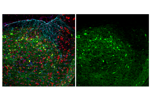 Immunofluorescence Image 1: Neurogranin (E9L8D) Rabbit mAb