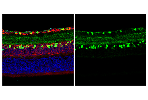 Immunofluorescence Image 2: Neurogranin (E9L8D) Rabbit mAb