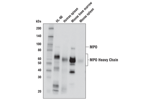 Western Blotting Image 1: Myeloperoxidase Antibody