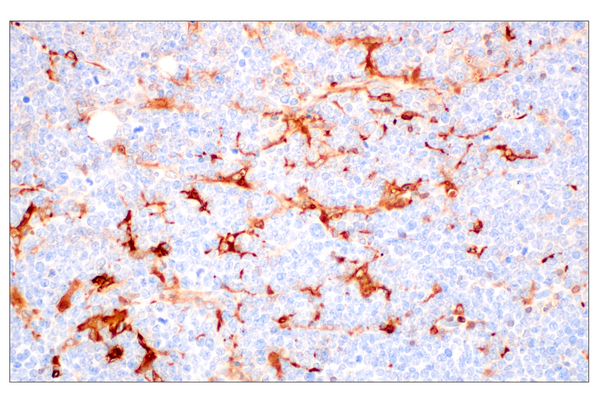 Immunohistochemistry Image 8: FTL (F9O4I) Rabbit mAb