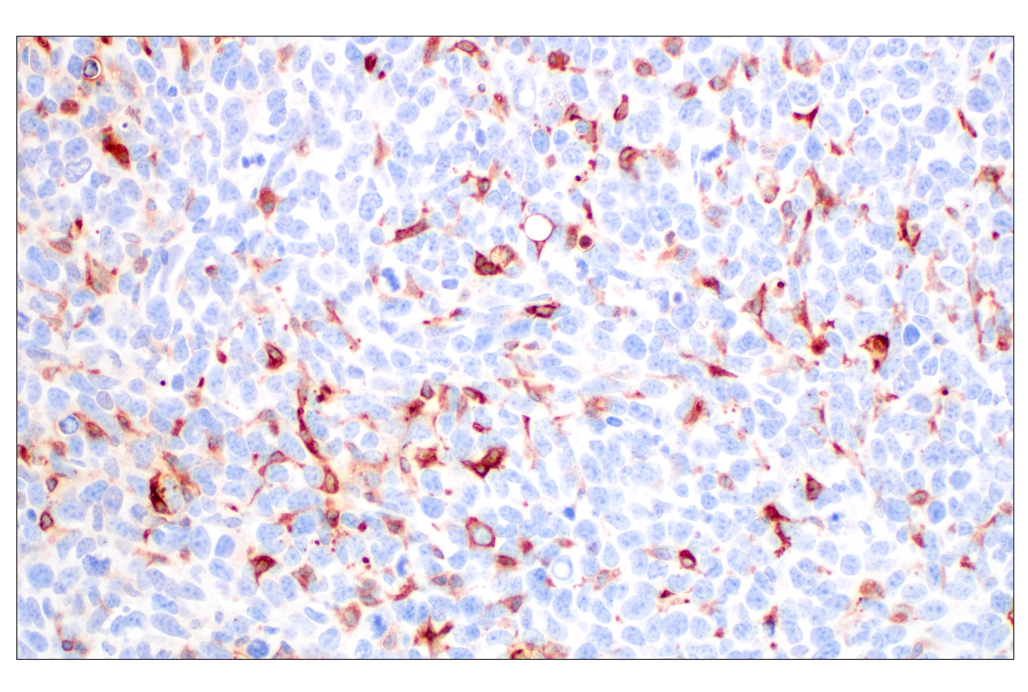 Immunohistochemistry Image 9: FTL (F9O4I) Rabbit mAb