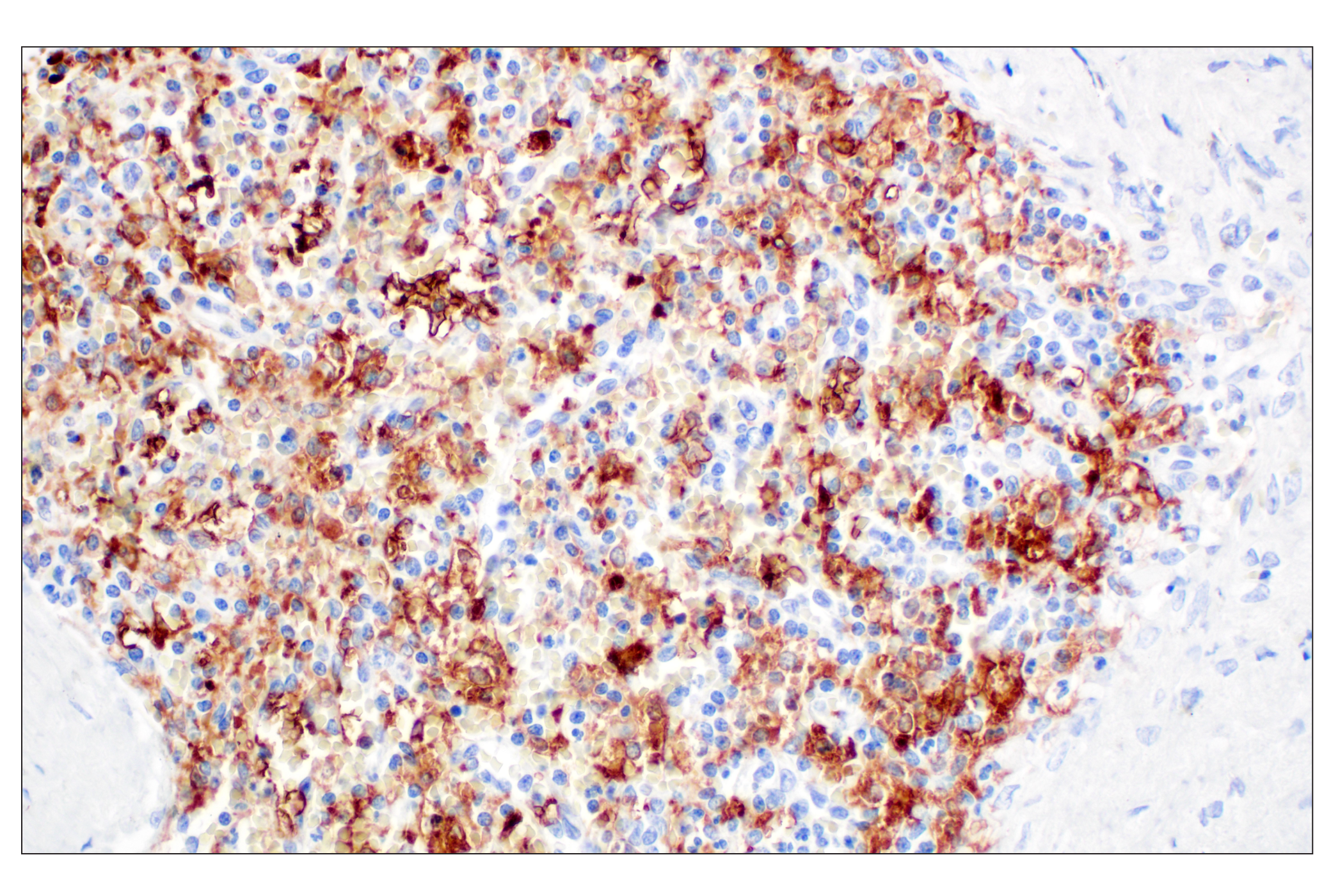 Immunohistochemistry Image 7: FTL (F9O4I) Rabbit mAb