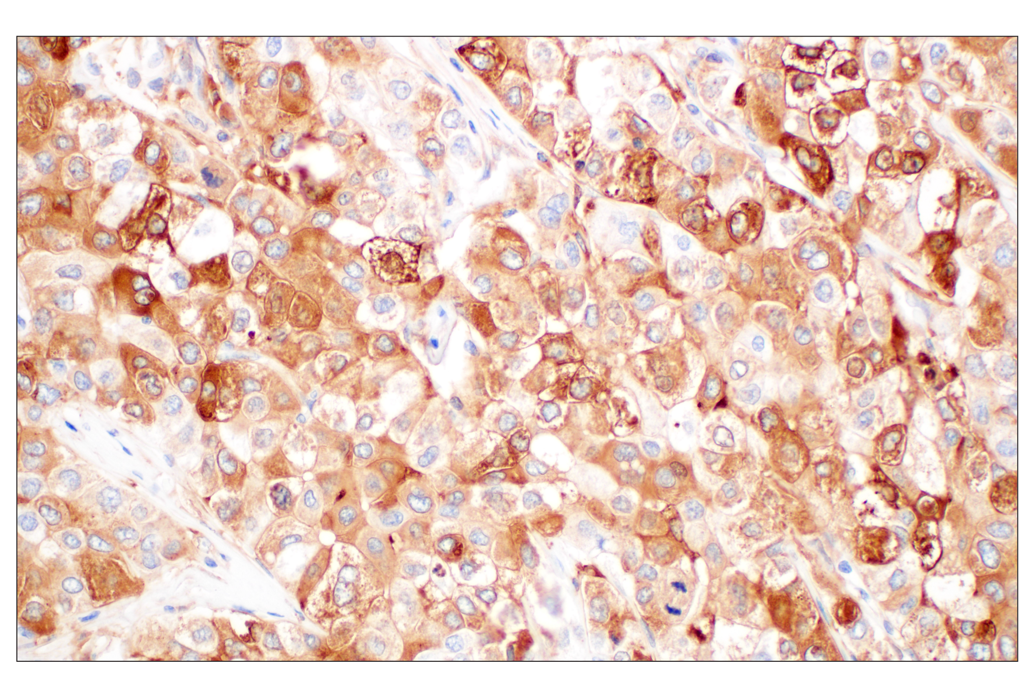 Immunohistochemistry Image 1: FTL (F9O4I) Rabbit mAb