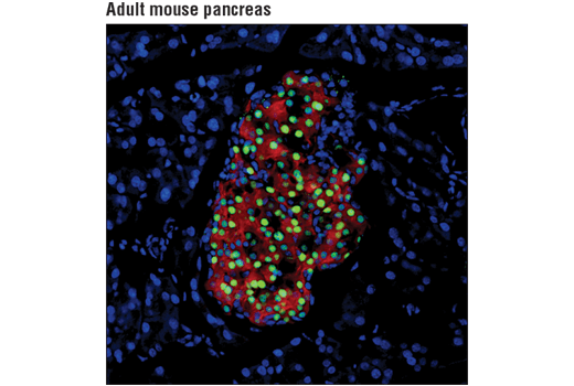 Immunofluorescence Image 1: MAFA (D2Z6N) Rabbit mAb