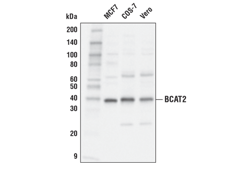  Image 3: Branched-Chain Amino Acid Metabolism Antibody Sampler Kit
