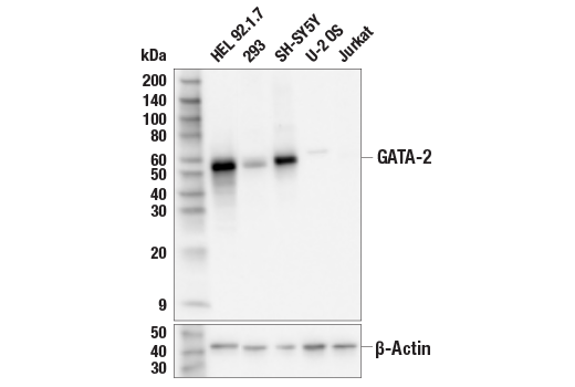  Image 11: GATA Transcription Factor Antibody Sampler Kit