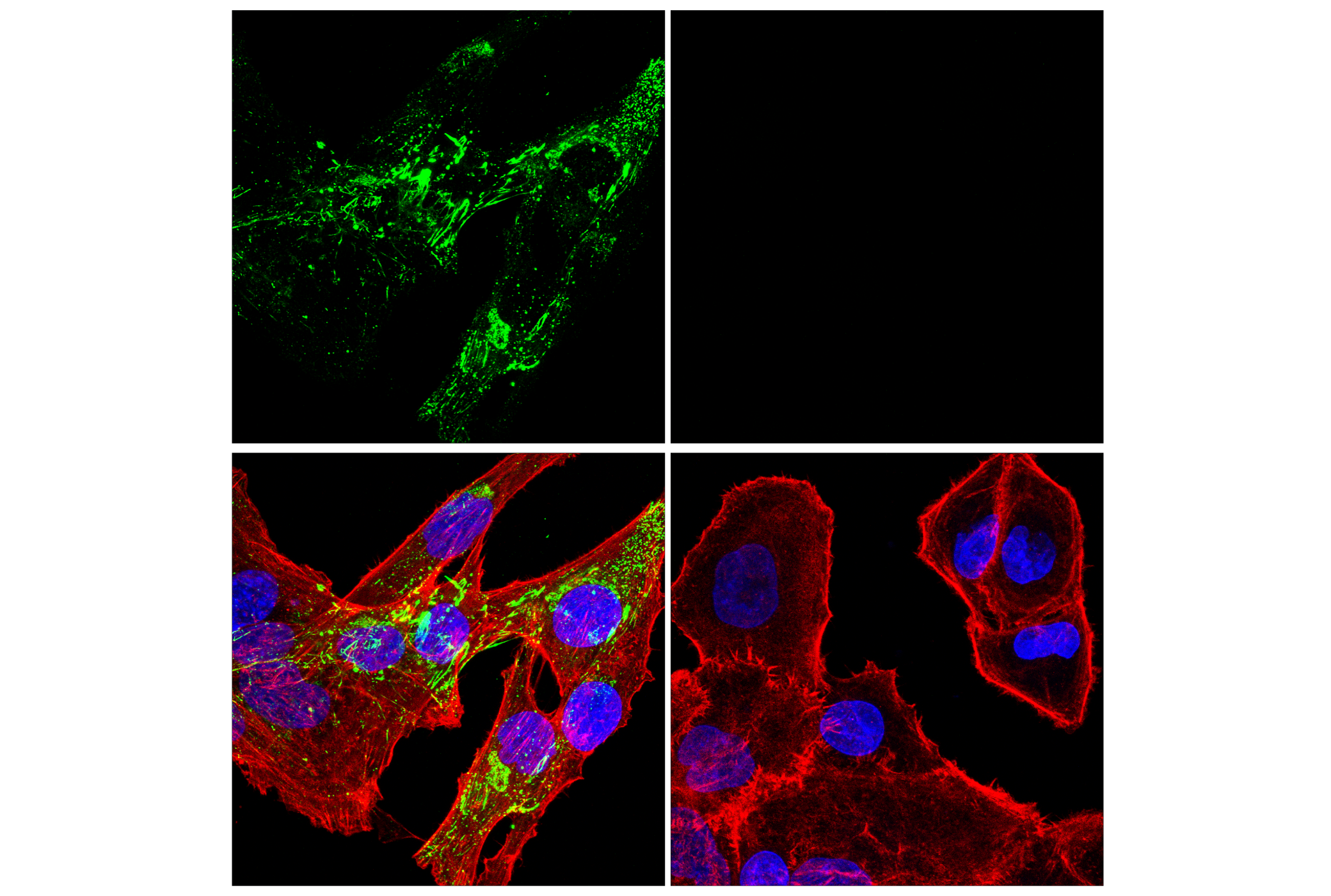 Immunofluorescence Image 1: Fibronectin/FN1 (E5H6X) Rabbit mAb (Alexa Fluor® 488 Conjugate)