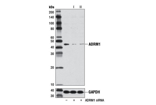  Image 1: SignalSilence® ADRM1 siRNA I