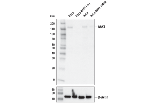 Western Blotting Image 1: AAK1 Antibody