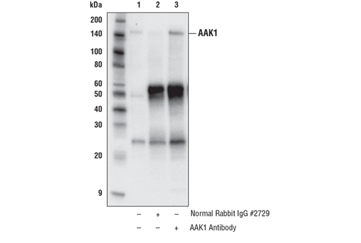 Immunoprecipitation Image 1: AAK1 Antibody