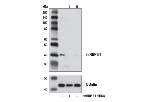  Image 1: SignalSilence® hnRNP E1 siRNA II