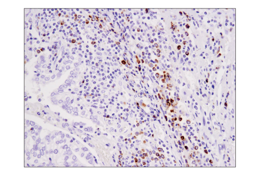 Immunohistochemistry Image 2: Granzyme B (D6E9W) Rabbit mAb (BSA and Azide Free)