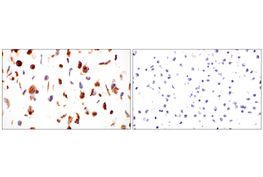 Immunohistochemistry Image 8: Periostin (E5F2S) Rabbit mAb (BSA and Azide Free)