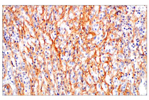Immunohistochemistry Image 2: Periostin (E5F2S) Rabbit mAb (BSA and Azide Free)