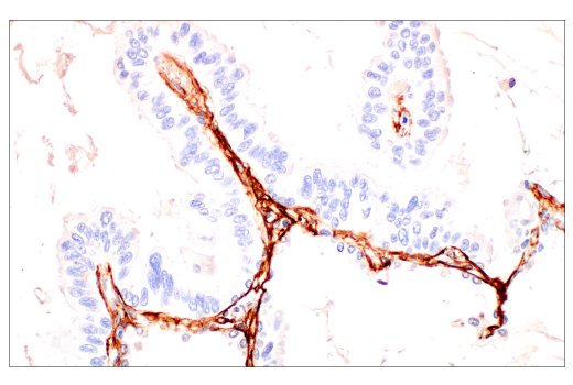 Immunohistochemistry Image 3: Periostin (E5F2S) Rabbit mAb (BSA and Azide Free)