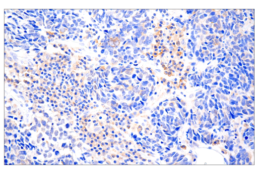 Immunohistochemistry Image 1: cGAS (E5V3W) Rabbit mAb