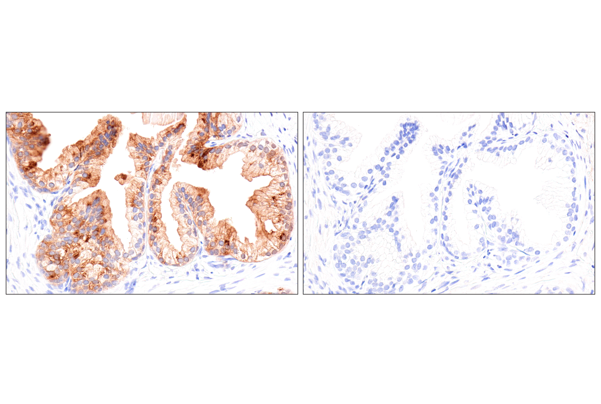 Immunohistochemistry Image 6: GDF15/MIC1 (E5Q8Q) Rabbit mAb