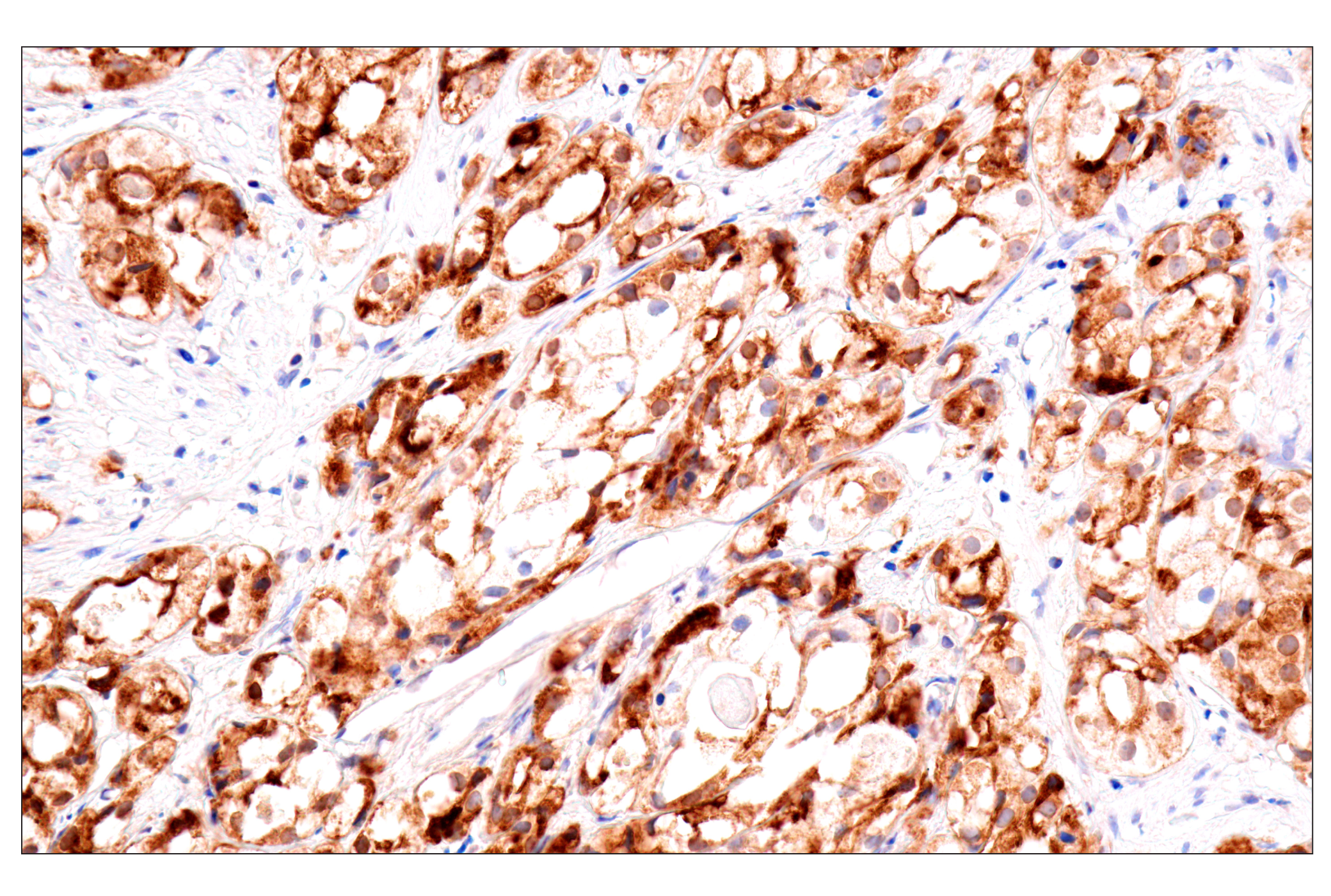 Immunohistochemistry Image 2: GDF15/MIC1 (E5Q8Q) Rabbit mAb